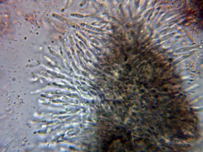 Ceuthospora buxi 10 - Conidióforos 4